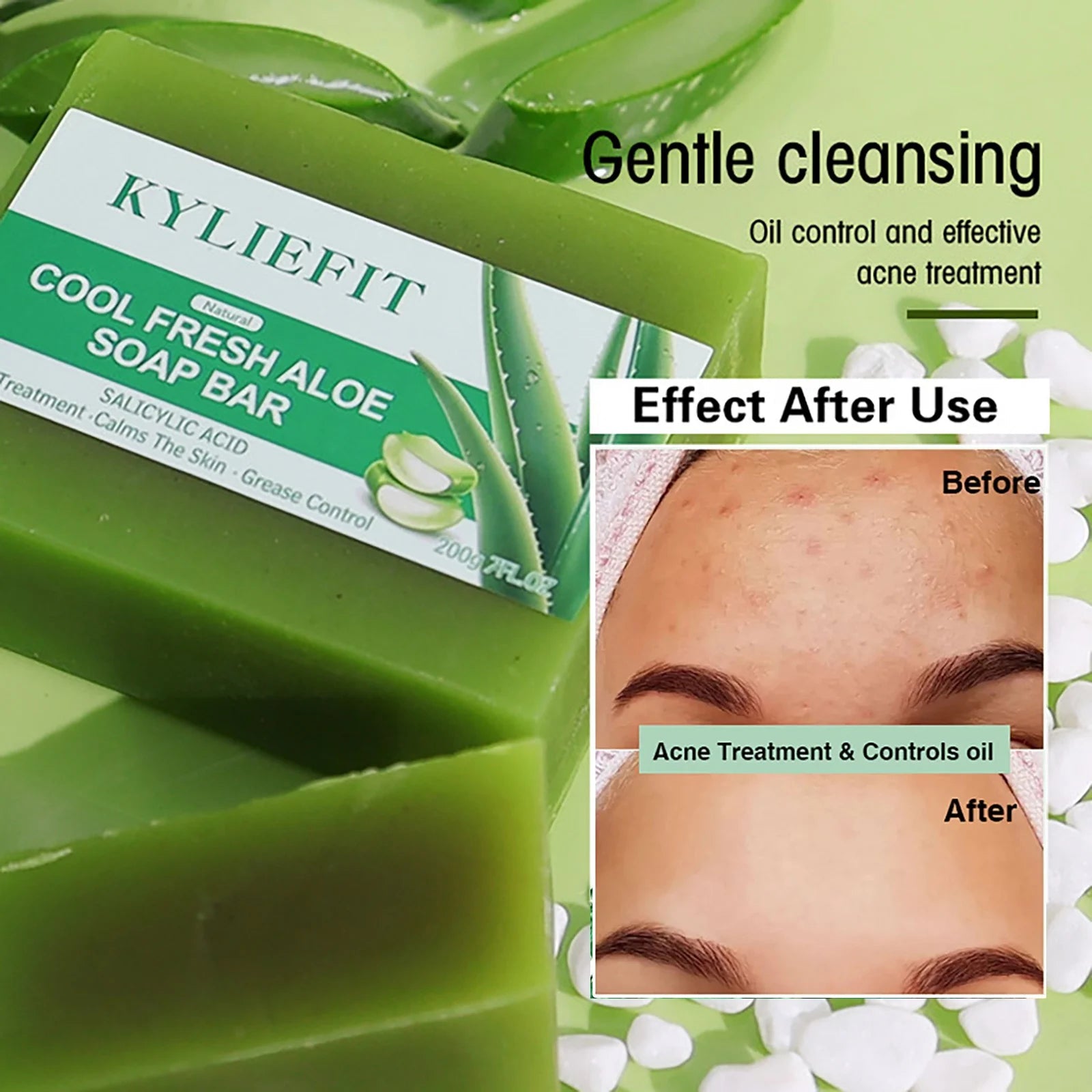 Aloe Brightening Soap Bar, Remove Dark Spots, Sun Spots, Acne, Oil Control, Clean Stains, Exfoliation, For Face and Body, 200g Halalzen