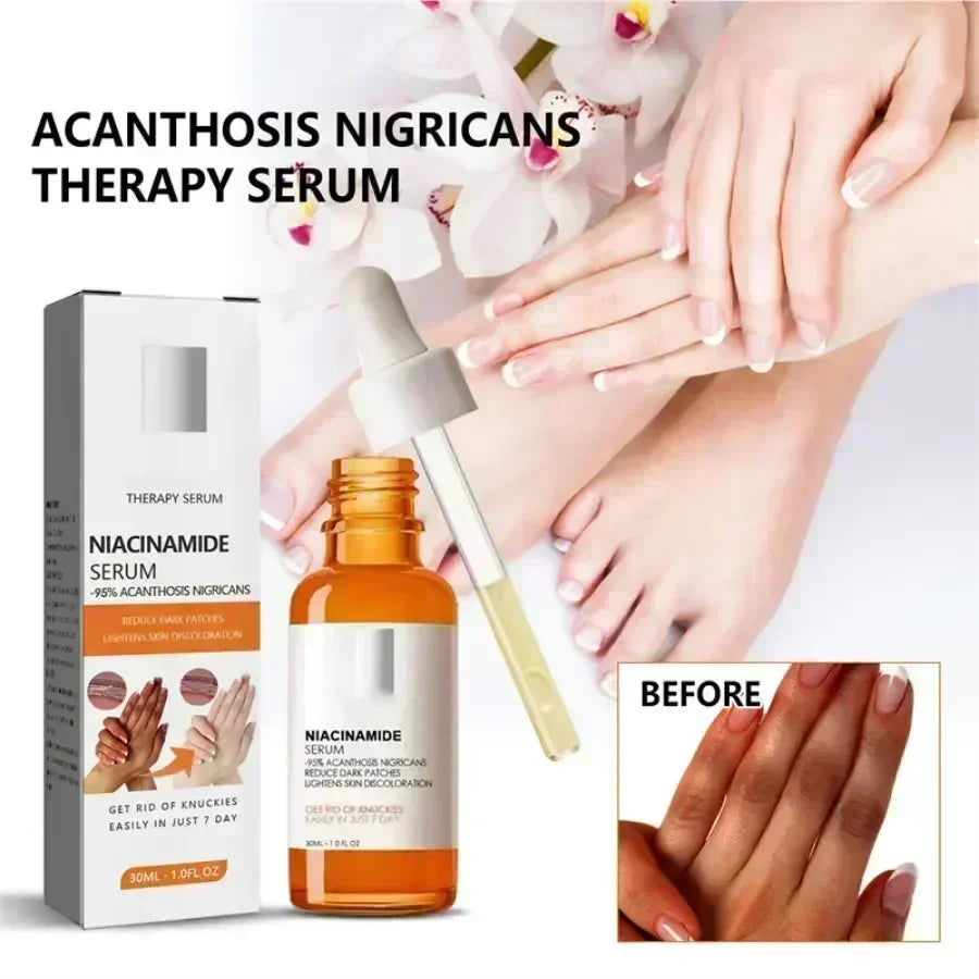 Dark knuckles whitening serum Elbows Armpit Beaching SerumWoman Private Part Skin Removal Dark Knuckles Strong Whitening Serum Halalzen