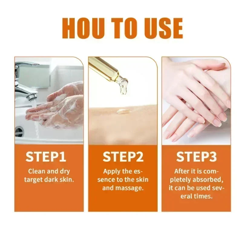 Dark knuckles whitening serum Elbows Armpit Beaching SerumWoman Private Part Skin Removal Dark Knuckles Strong Whitening Serum Halalzen