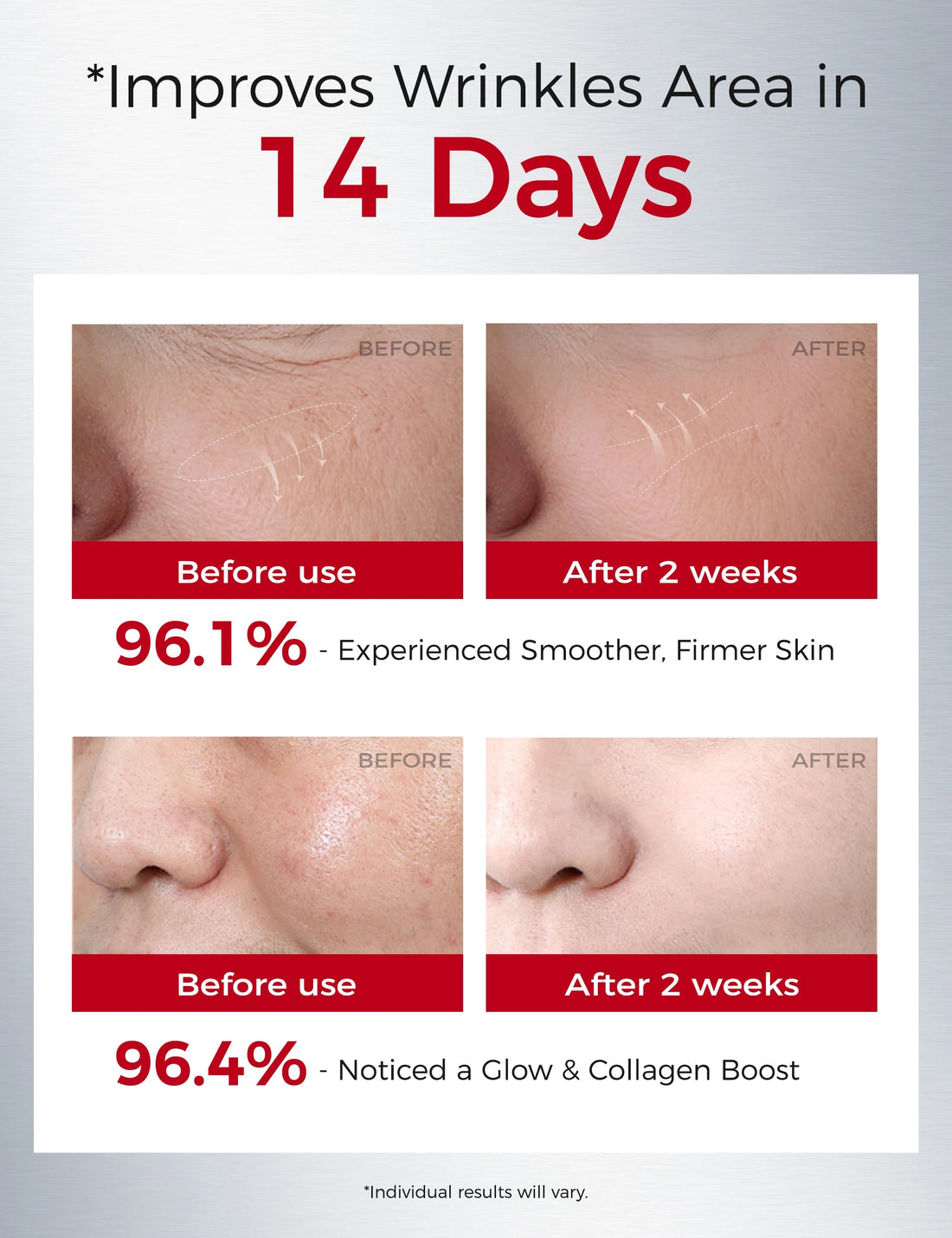 3pcs Retinol Face Serum: Boost Firmness, Brightness & Moisture with Carnosine & Centella Extract Halalzen