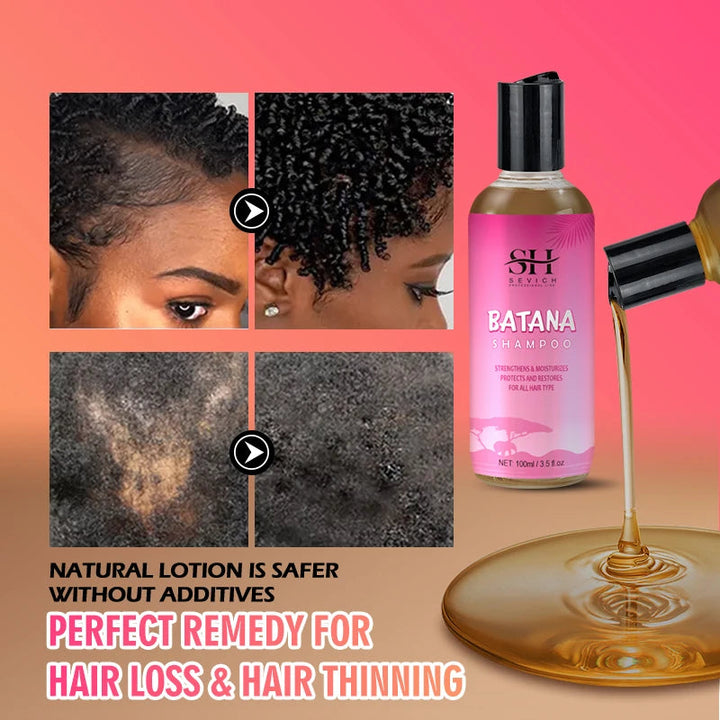 Batana Hair Growth Shampoo Conditioner Set Anti Hair Loss Treatment for Men Women Fast Thicken Regrowth Oil Beauty Health SEVICH Halalzen