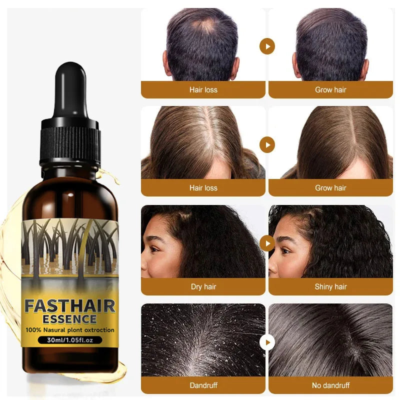 Hair growth plant essence oil beauty care anti hair loss essence natural repair damaged hair HALALZEN