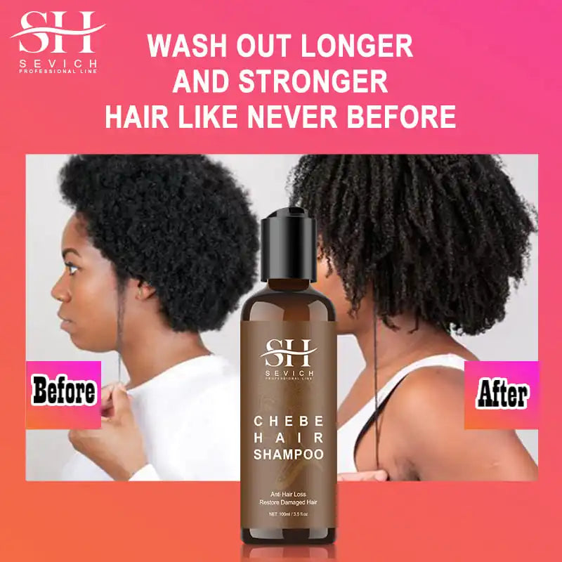 CHEBE Hair Growth Shampoo Conditioner Set Anti Hair Loss Treatment for Men Women Fast Thicken Regrowth Oil Beauty Health SEVICH Halalzen