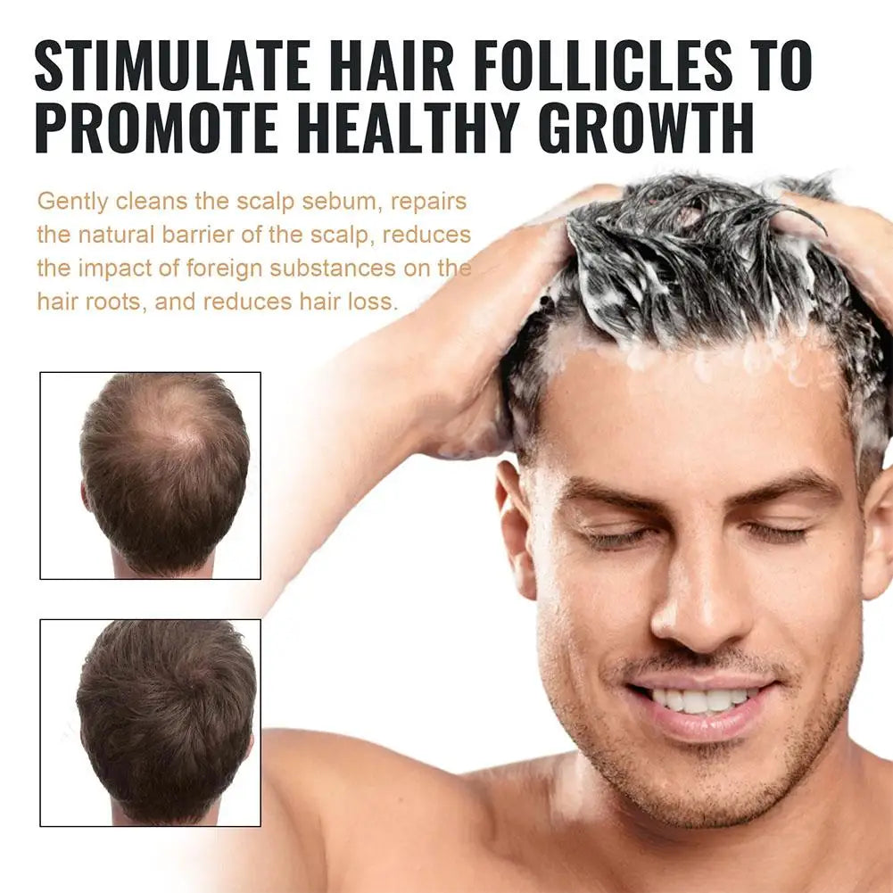 Hair Thickening Shampoo Hair Root Activator Shampoo Nourish Hair Regrowth Shampoo For Thinning Hair & Hair Loss