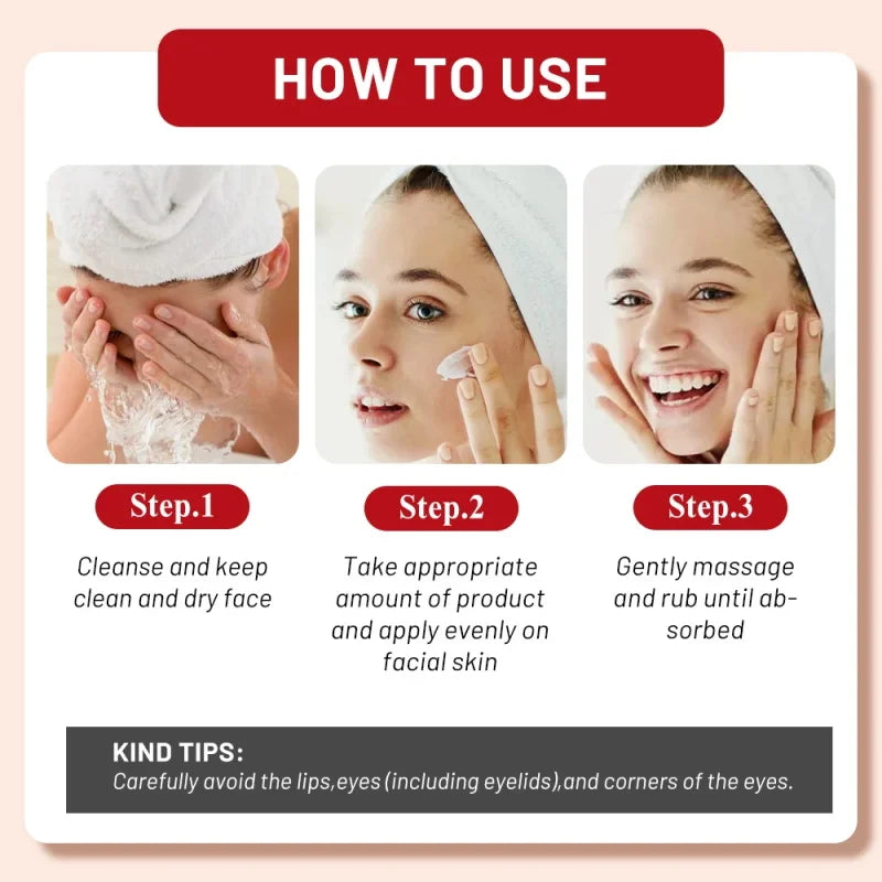 Powerful Spot-Removing Whiten Cream Brighten Skin Fast Eliminates Melanin Pigmentation Melasma Dark Spots Korean Face Skin Care