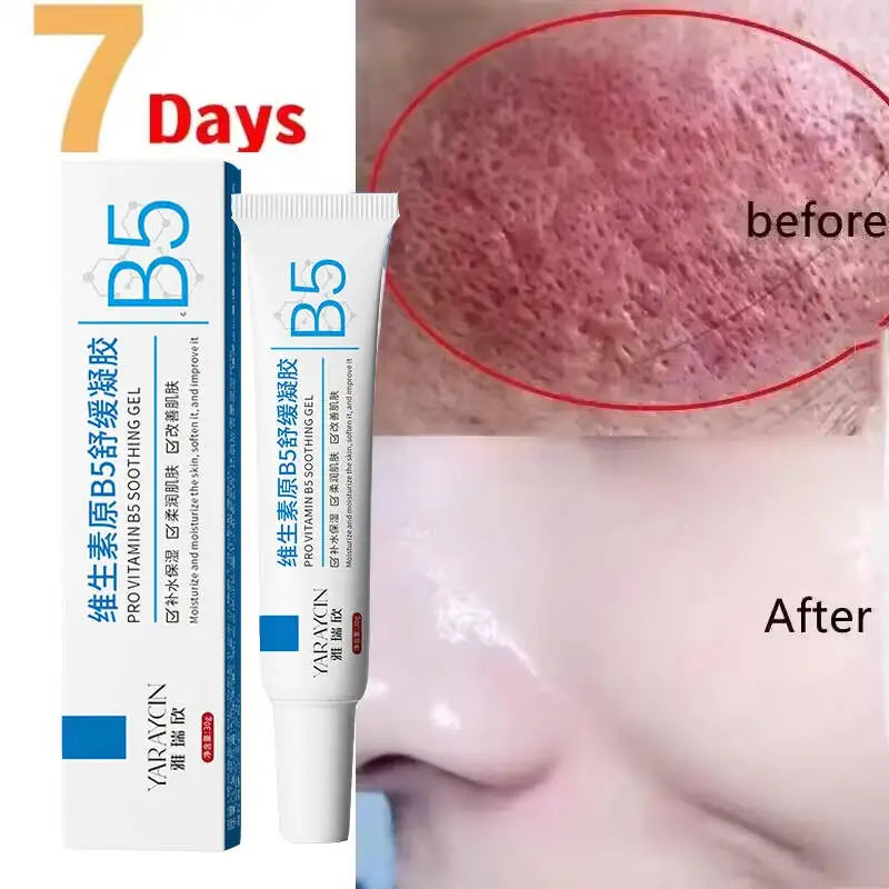 Facial Redness Repair Cream Improve Sensitive Skin Dryness Moisturizer Hydrating Sooth Lotion Removal Rosacea Korean Cosmetics Halalzen