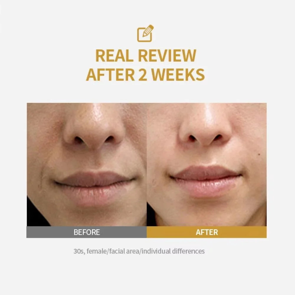 Peptide Intensive Lifting Ampoule,Deep Collagen Face Firming Moisturizing Serum,Glass Skin Tightening Hydration,Korean Skincare