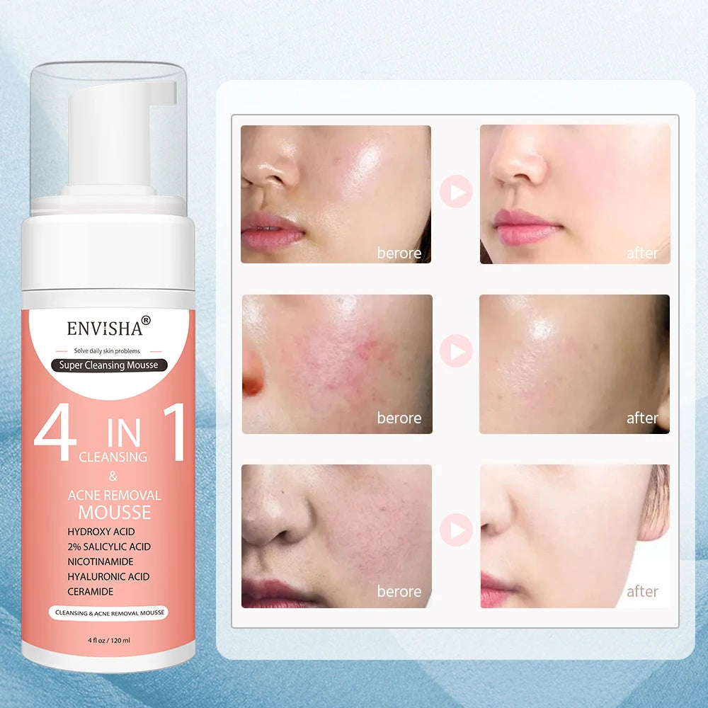 ENVISHA Facial Skin Care Exfoliating Mousse Peeling Gel Deep Remove Cleaning Smooth Moisturizing Cream Whitening Shrinking Pores Halalzen