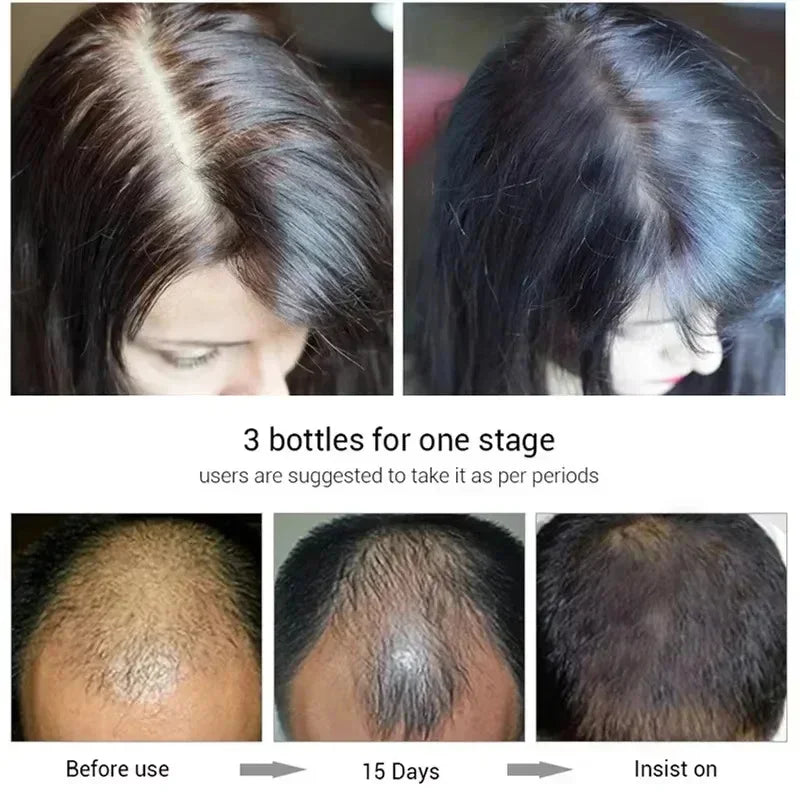 Hair Growth Serum 7 Day Fast Regrowth Essential Capsule Anti Hair loss Baldness Repair Damaged Scalp Treatment For Women Men New
