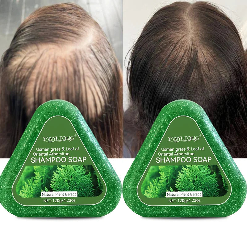 Usman Grass & Platycladus Shampoo Bar For Hair Growth Natural Herbal Soap For Hair Loss Controls Oil Strengthens Roots Shampoo