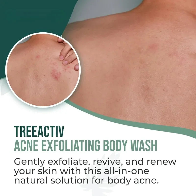 EHD Salicylic Acid  Fragrance Body Wash Gentle Exfoliating for Blemish-Prone Skin,Oil Control pH Balance Shower Gel Smooth Skin Halalzen