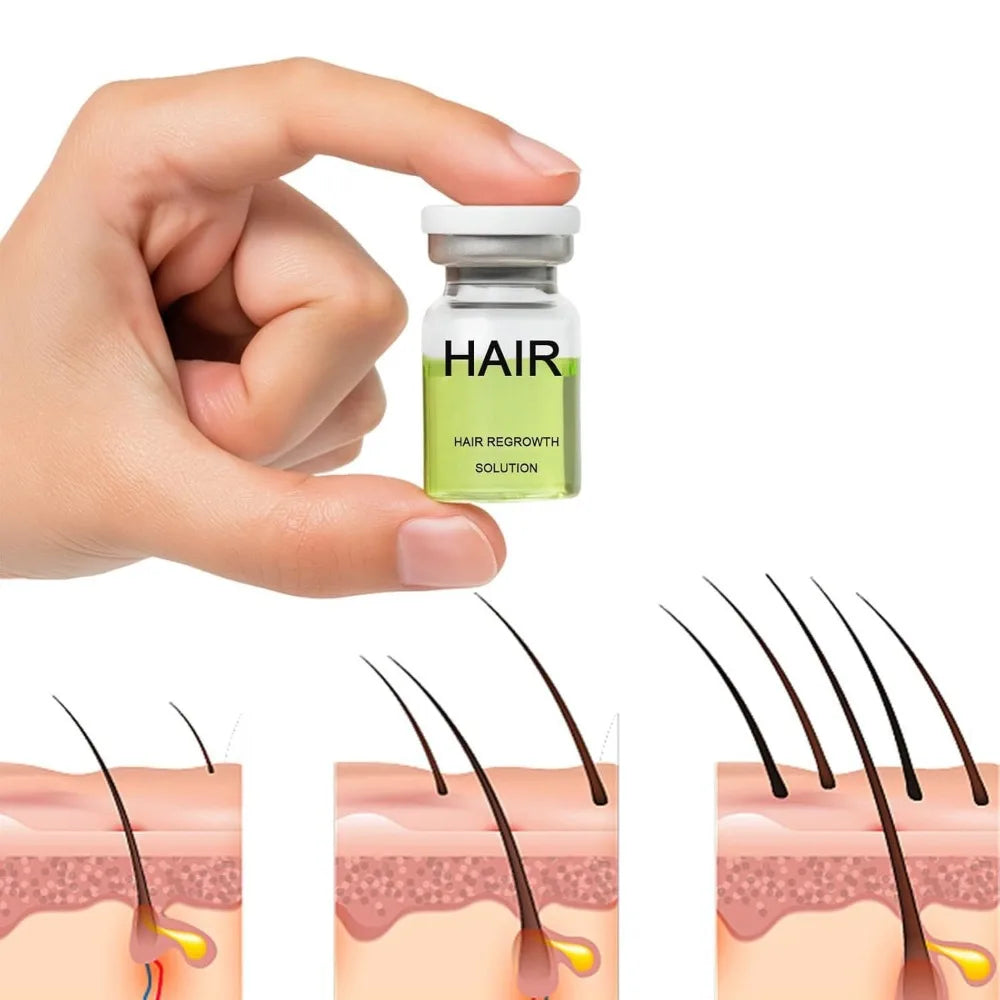 Hair Roller Serum Gentle nourishes the scalp and cares for the softening hair care Daily Care Scalp Serum HALALZEN