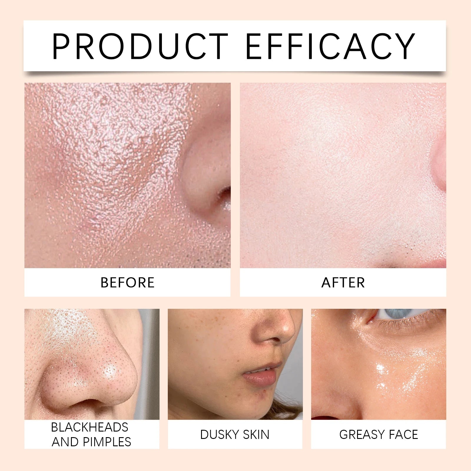Papaya Face Wash Deep Exfoliating Oil Control Prevents Acne & Blackheads Brightening Pore Minimizing Cleanser For All Skin Types Halalzen