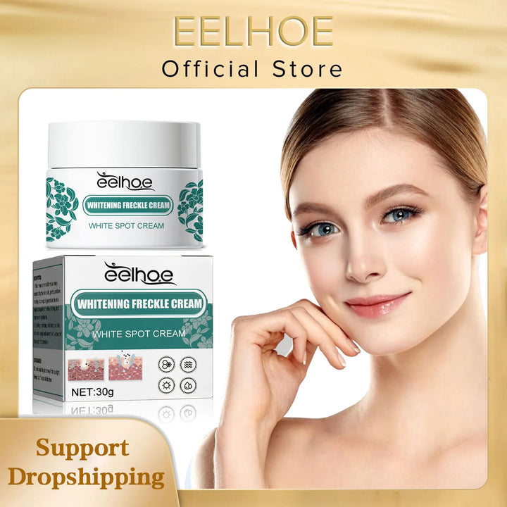Whitening Freckle Cream Remove Acne Age Spot Melanin Sunburn Repair Anti Pigmentation Even Skin Tone Brighten Melasma Remover