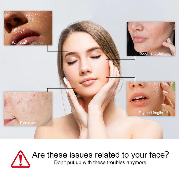Facial Cleanser Anti Acne Oil Control Blackhead Remover Shrink Pores Deep Cleansing Acne Treatment Moisturizing Face Wash 100g Halalzen