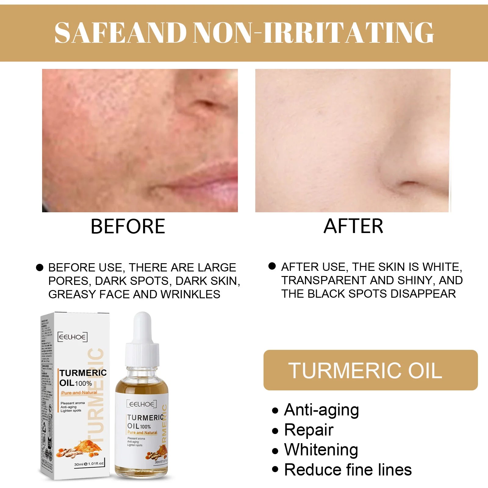 Turmeric Repair Essence For Reduces Dark Spots & Freckles,Moisturizes Face,Brightens And Evens Skin Tone,Improves Damaged Skin