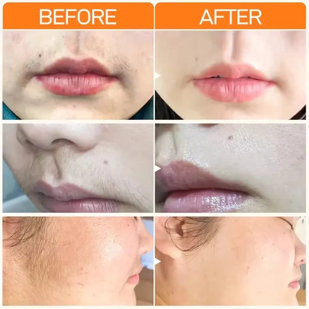 3 Minutes Fast Hair Removal Cream Painless Hair Growth Inhibitor Lip Face Arm Armpit Leg Permanent Depilatory for Men Women Care HALALZEN