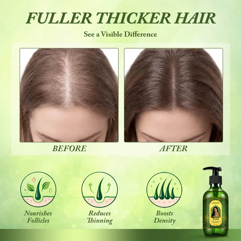 300ml Shampoo Anti-Hair Loss & Hair Regrowth Strengthens Hair Controls Oil Refreshes Adds Volume Scalp Care Products for Family