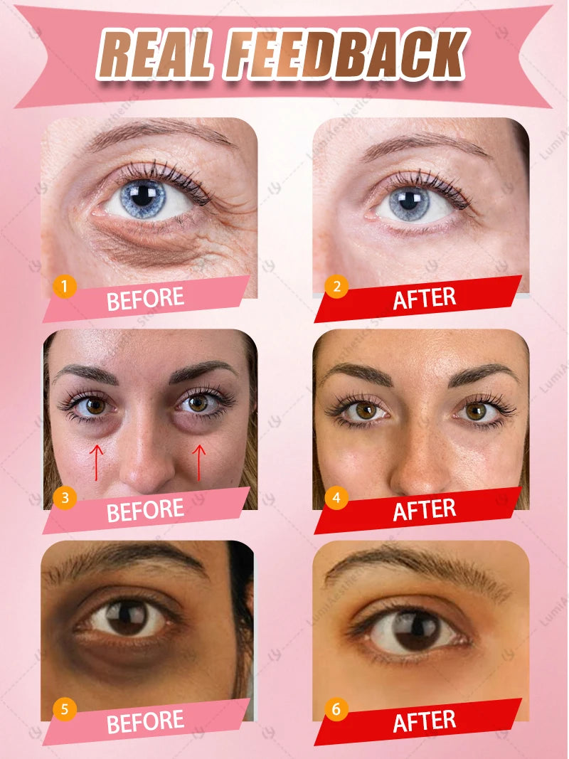 Puffy Eyes Cream For Dark and De-puffing Eyes