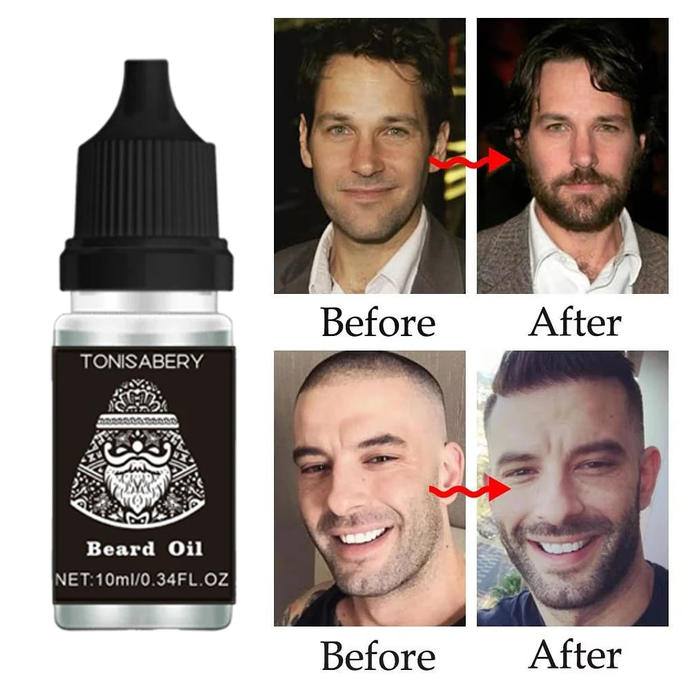 High Quality Fast Beard Growth Serum For Men Promote Beard Regrowth Thicker Longer Fuller Anti Hair Loss Essential Oil Hair Care