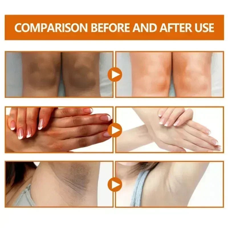 Dark knuckles whitening serum Elbows Armpit Beaching SerumWoman Private Part Skin Removal Dark Knuckles Strong Whitening Serum Halalzen