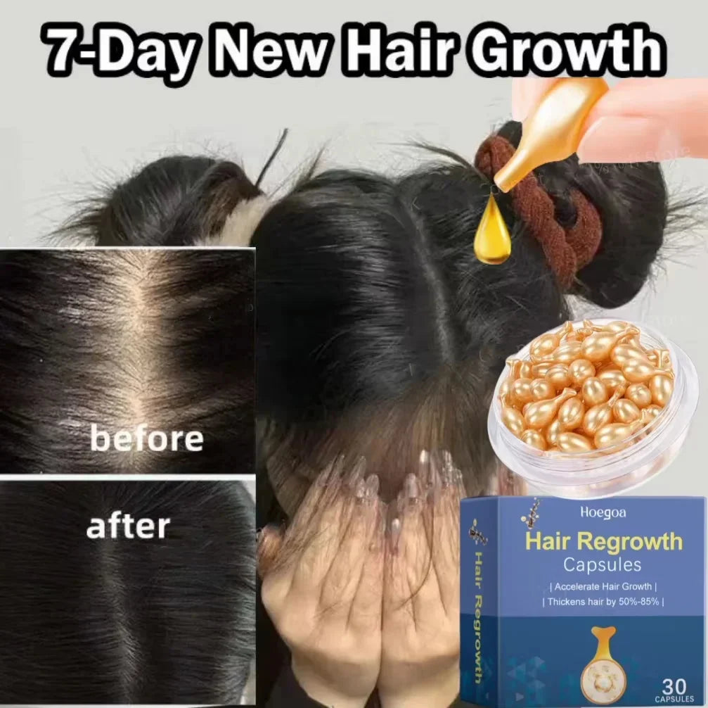Hair Growth Serum 7 Day Fast Regrowth Essential Capsule Anti Hair loss Baldness Repair Damaged Scalp Treatment For Women Men New