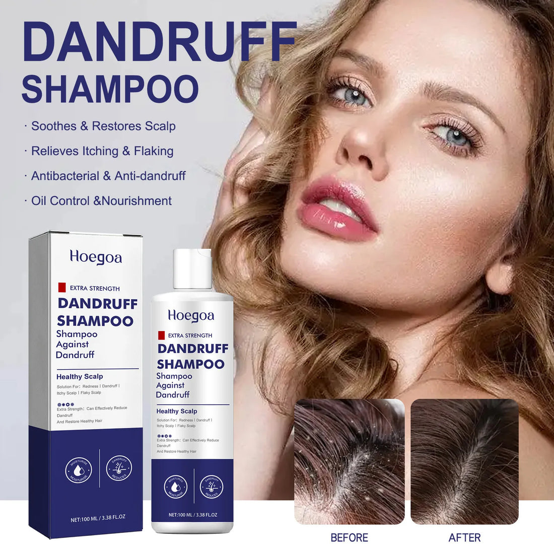 Folliculitis Shampoo Hair Loss Prevention Deep Scalp Cleansing Strengthening Hair Thickening Care Shampoo