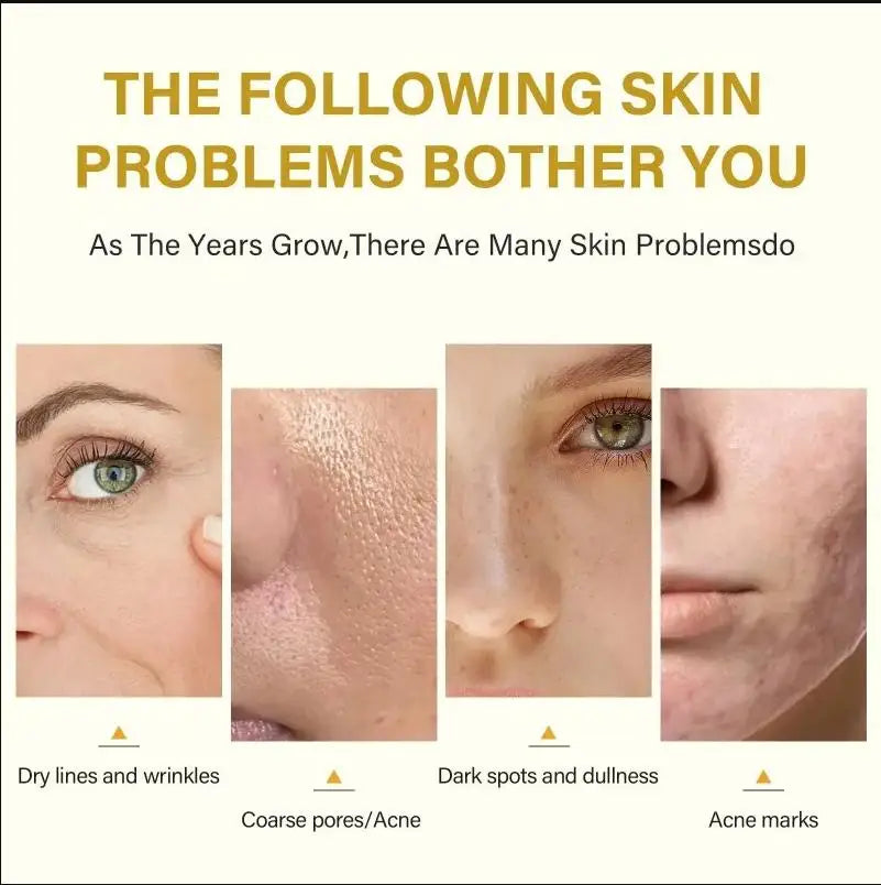 Face Care Exfoliating Serum Radiant Skin Fade Dark Spots Pigmentation for Even Brighter Skin Remove Spots Arm Knee Legs Melanin