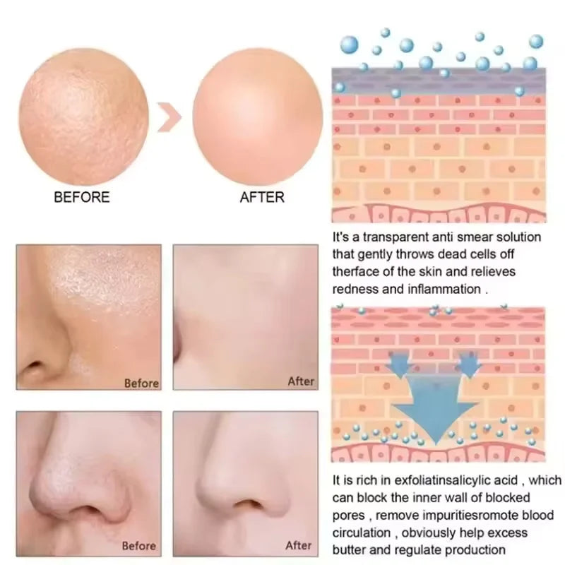 Centella Clay Mud Stick Mask Pore Minimizing Quick Shrink Pores Remove Blackheads Acne Scars Moisturizing Brighten Korean Makeup