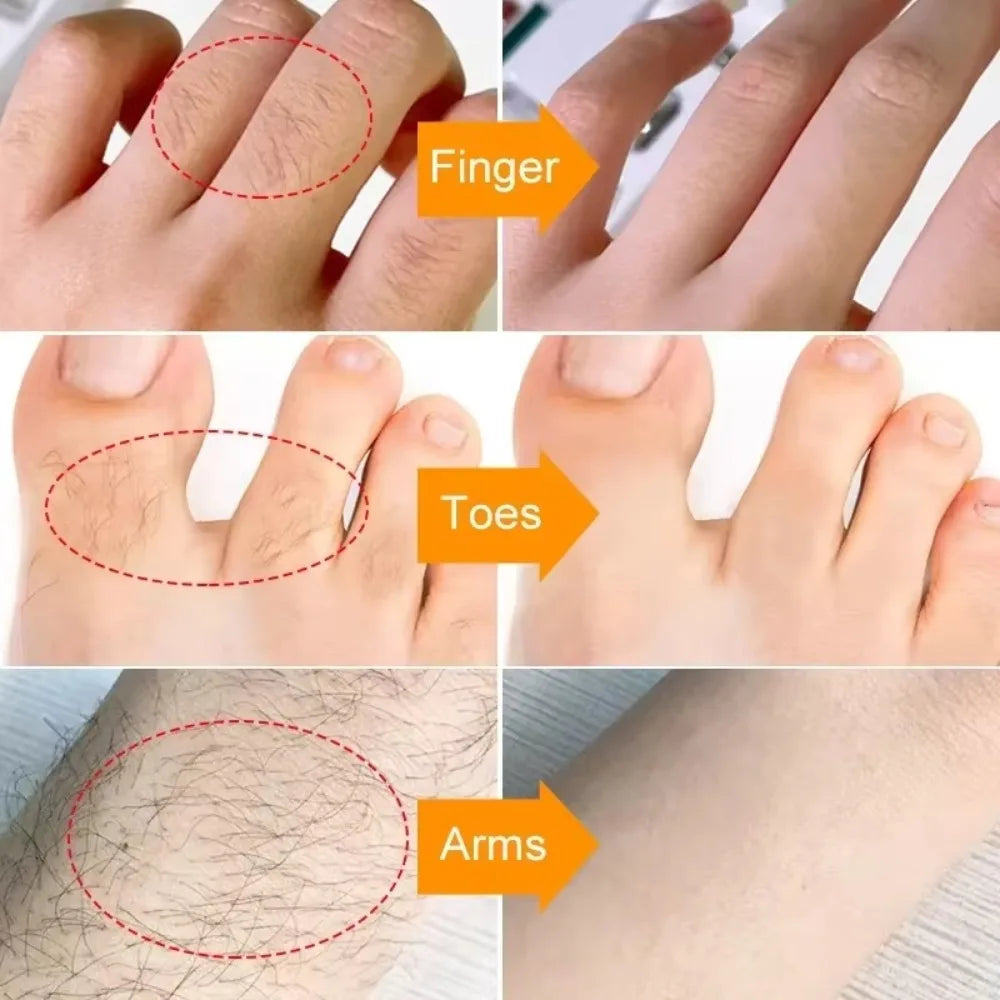 3 Minutes Fast Hair Removal Cream Painless Hair Growth Inhibitor Lip Face Arm Armpit Leg Permanent Depilatory for Men Women Care HALALZEN