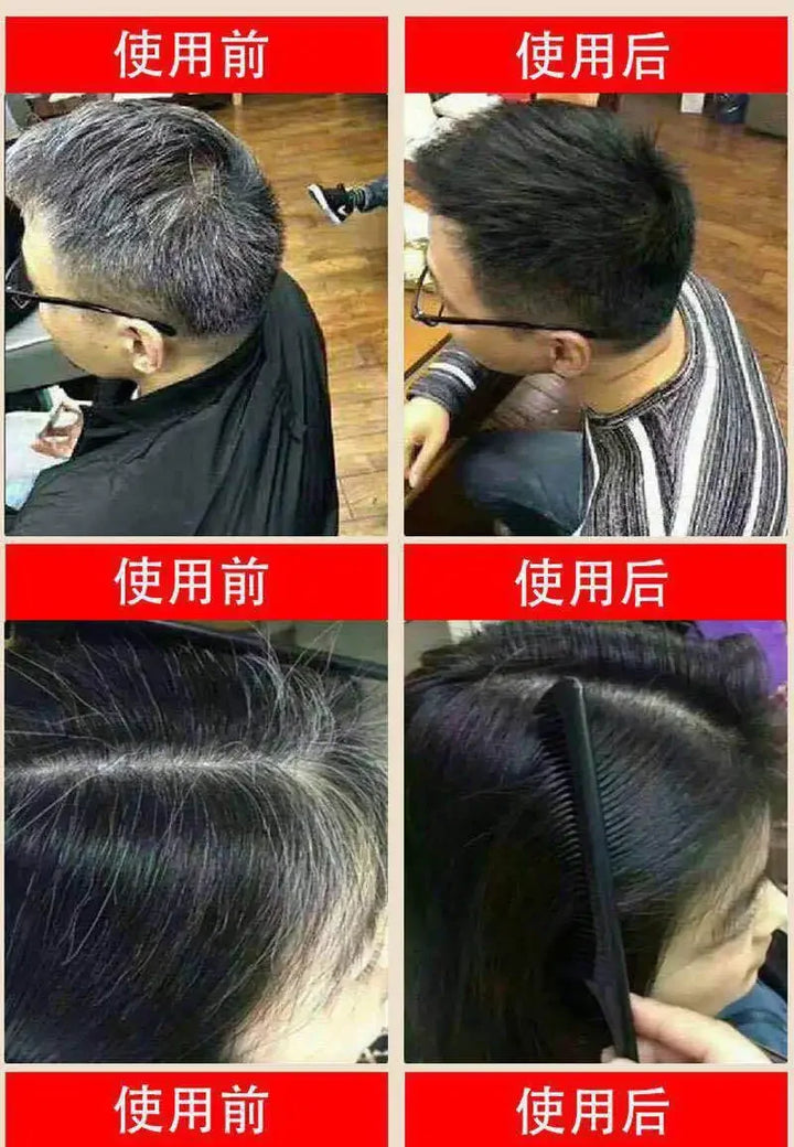 Herbal Polygonum Shampoo 300ml Effective Grey Hair Remover Anti White Hair Treatment Blacken White To Black Moisturizing Shampoo