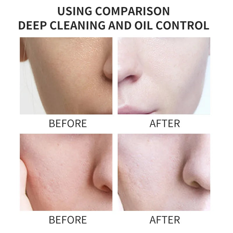 Kojic Acid Skin Care Facial Wash Mild Oil Control Deep Cleaning Moisturizing Cleansing Nonirritating Face Cleanser Face Wash Halalzen