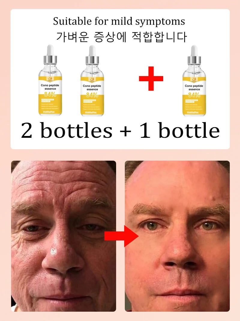 Peptide Facial Essence Serum Hyaluronic Acid Collagen Blend Deep Hydration Skin Elasticity Care Daily Beauty Treatment