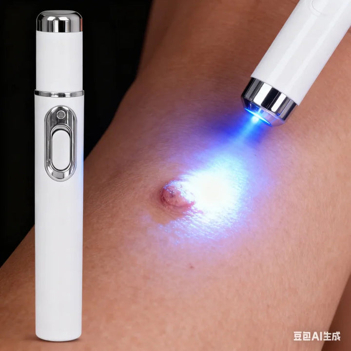 Blue light wart removal tools to make your life better. Halalzen