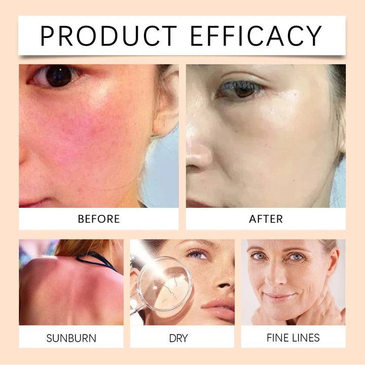 EELHOE Vitamin E Sunscreen Spray 100ml Long-lasting Deep Moisturizing Anti-UV Skin Protector Anti Oxidant Face Body Skin Care Halalzen