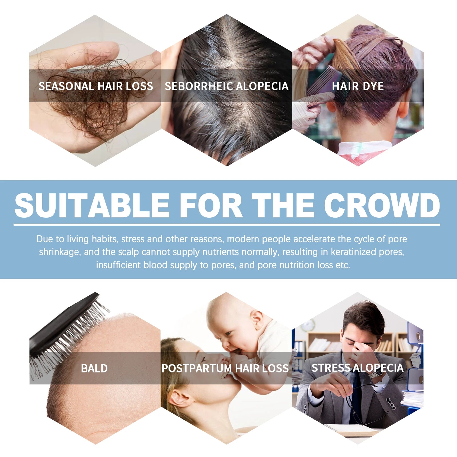 Hair Growth Ampoules Regrowth Anti Hair Loss Repair Split End Dry Damaged Hair Essential Oil Nourishing Scalp Portable Hair Care