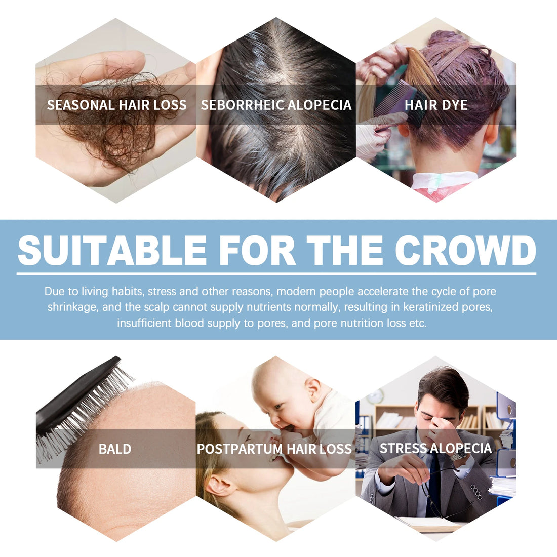 Hair Growth Ampoules Regrowth Anti Hair Loss Repair Split End Dry Damaged Hair Essential Oil Nourishing Scalp Portable Hair Care