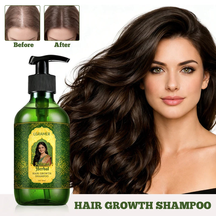Shampoo Anti-Hair Loss & Hair Regrowth Strengthens Hair Controls Oil Refreshes Adds Volume Scalp Care Products for Family 300ml