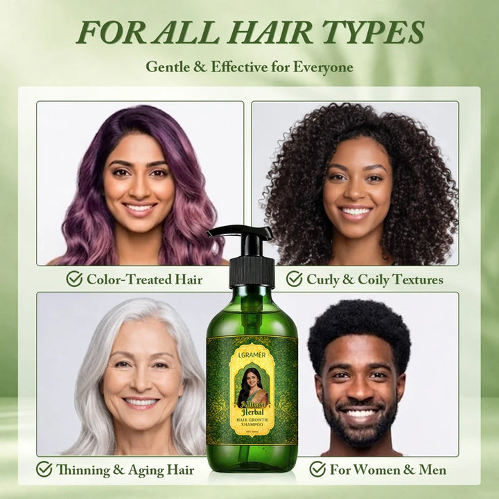 300ml Shampoo Anti-Hair Loss & Hair Regrowth Strengthens Hair Controls Oil Refreshes Adds Volume Scalp Care Products for Family
