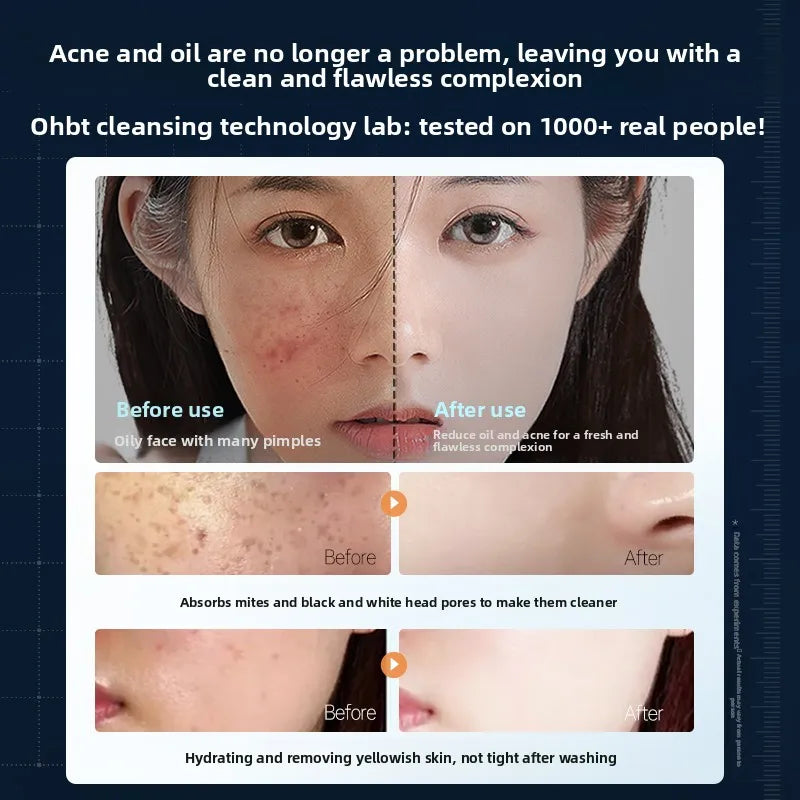 OHBT Amino Acid Cleansing Lotion Gentle Moisturizing Nourishing Salicylic Acid Facial Cleanser Oil Control Brightening Halalzen