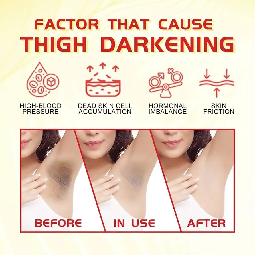 Body Whitening Cream Private Parts Underarm Dark Skin Bleaching Serum Niacinamide Whitening Lighten Dark Spots Snow Bleach Cream