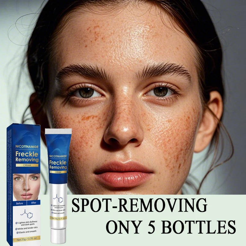 Dark Spot Remover for Face Removing Freckle target hyperpigmentation  age spots sun spot Whitening MOISTURIZING skin beauty care