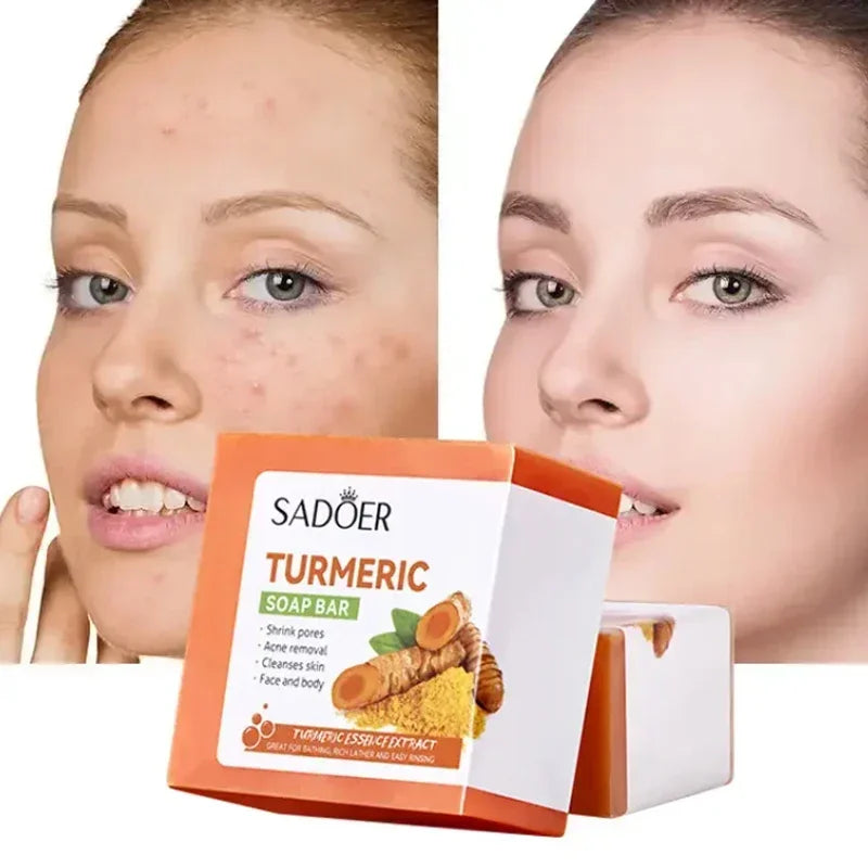 3 Pcs Handmade Turmeric Soap Set for Body Cleaning Lightening Dark Underarm Leg Skin Brightening Face Soap for Tender Skin Care Halalzen