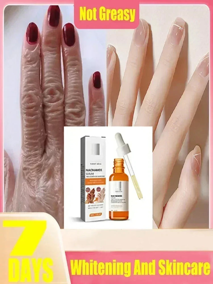 Dark knuckles whitening serum Elbows Armpit Beaching SerumWoman Private Part Skin Removal Dark Knuckles Strong Whitening Serum Halalzen