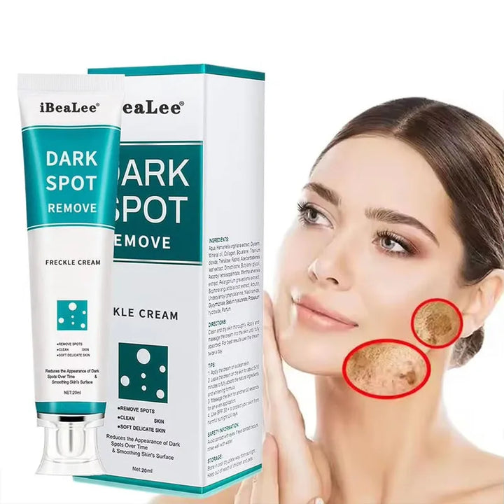 Melasma Brightening Face Cream Niacinamide Serum Brighten Cream Fade Fine Lines Lighten Dark Dot Reduce Melanin Face Skincare
