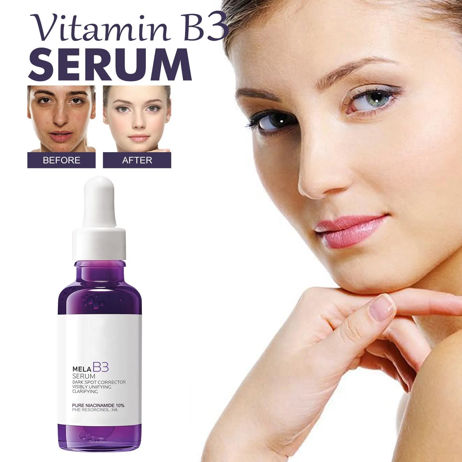 5in1 Rice Niacinamide VC Anti Aging Essence Brightening Fade Dark Spots Moisturizing Hydrating Glow Skin Care B3 Face Serum