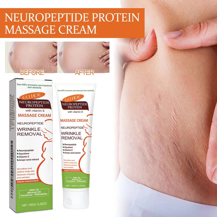 100g Stretch Marks Redece Cream Maternity Pregnant Women Pregnancy Faded Winkle Smooth Repair Firming Skin Body Care Product