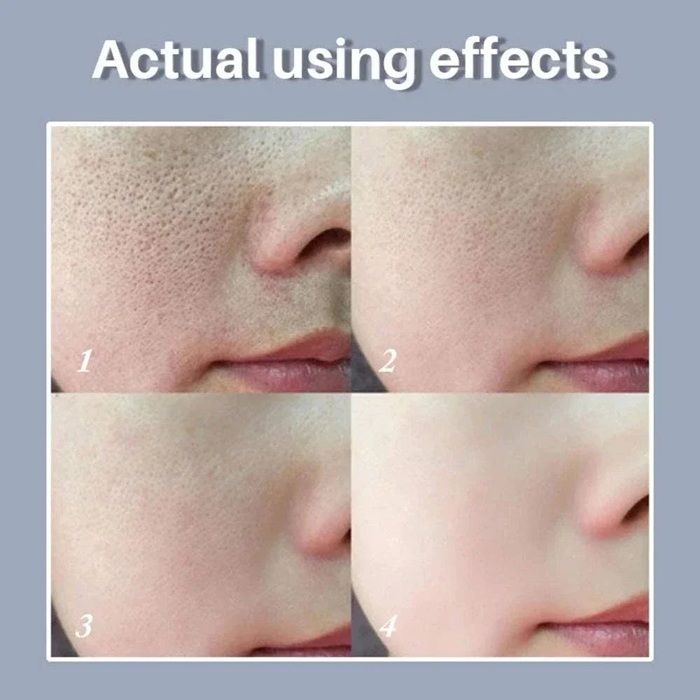 Skin Texture | Pore Refining Resurfacing, Brightening Facial Serum with Retinol and Niacinamide Non-Comedogenic Halalzen
