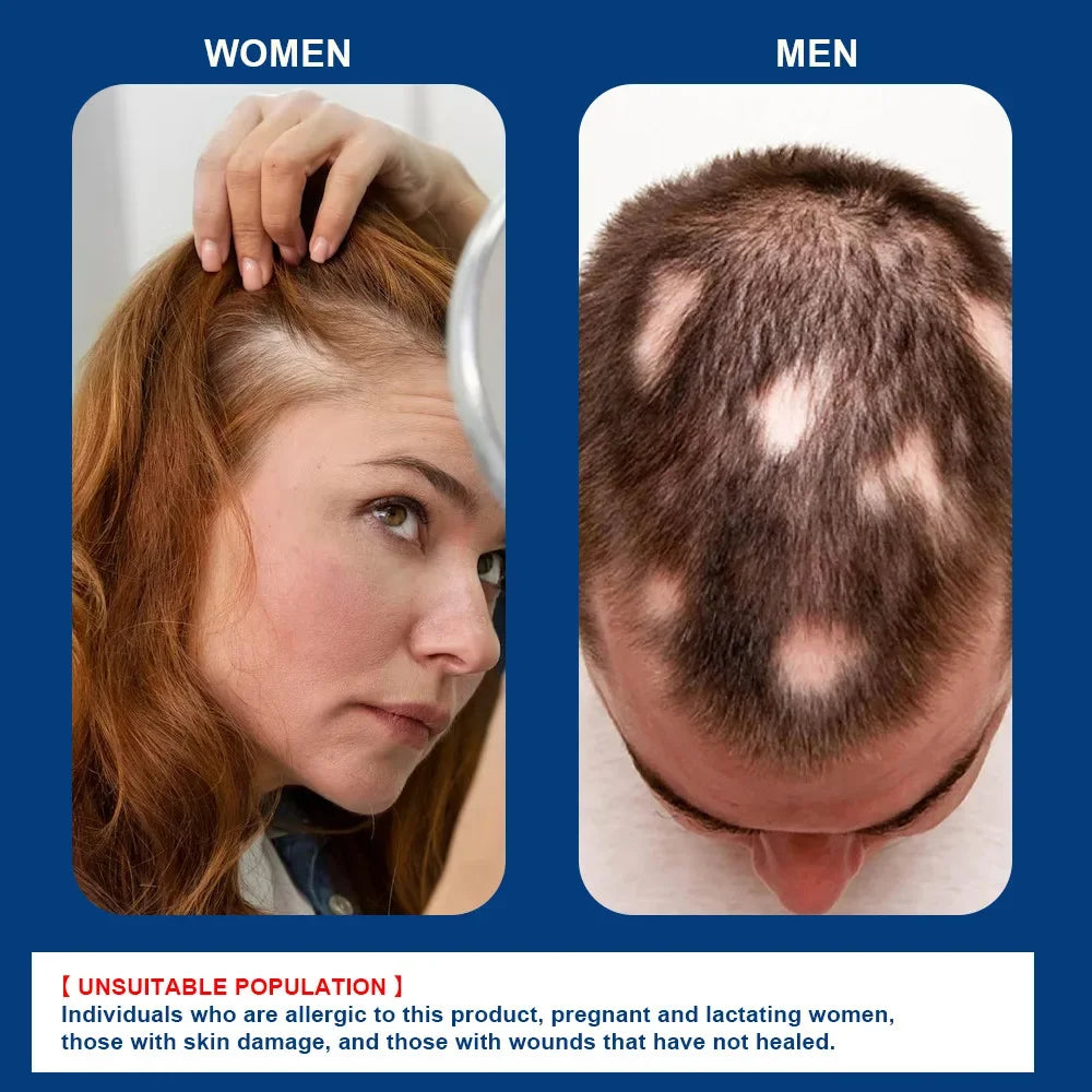 Fast Hair Growth Cream Anti Hair Loss Prevent Baldness Scalp Treatment Repair Roots Beauty Health Hair Care For Men Women