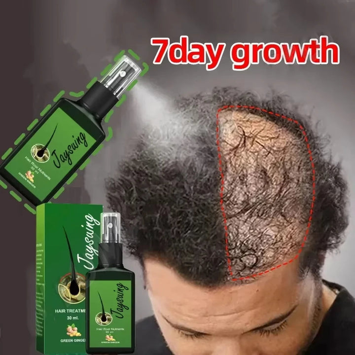 Fast Hair Growth Serum Spray Anti Hair Loss Prevent Baldness Scalp Treatment Repair Roots Beauty Health Hair Care For Men Women HALALZEN